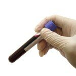 Phlebotomy Technician